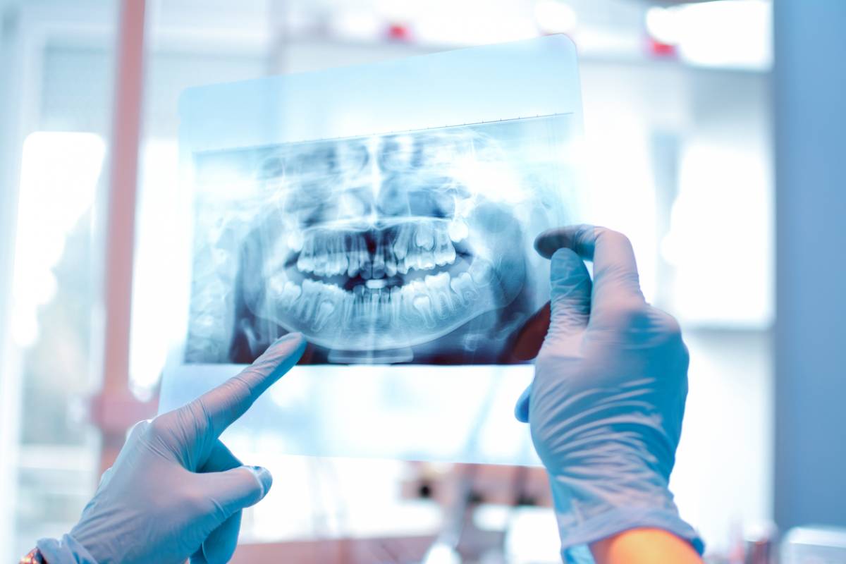 concept of importance of dental x-rays