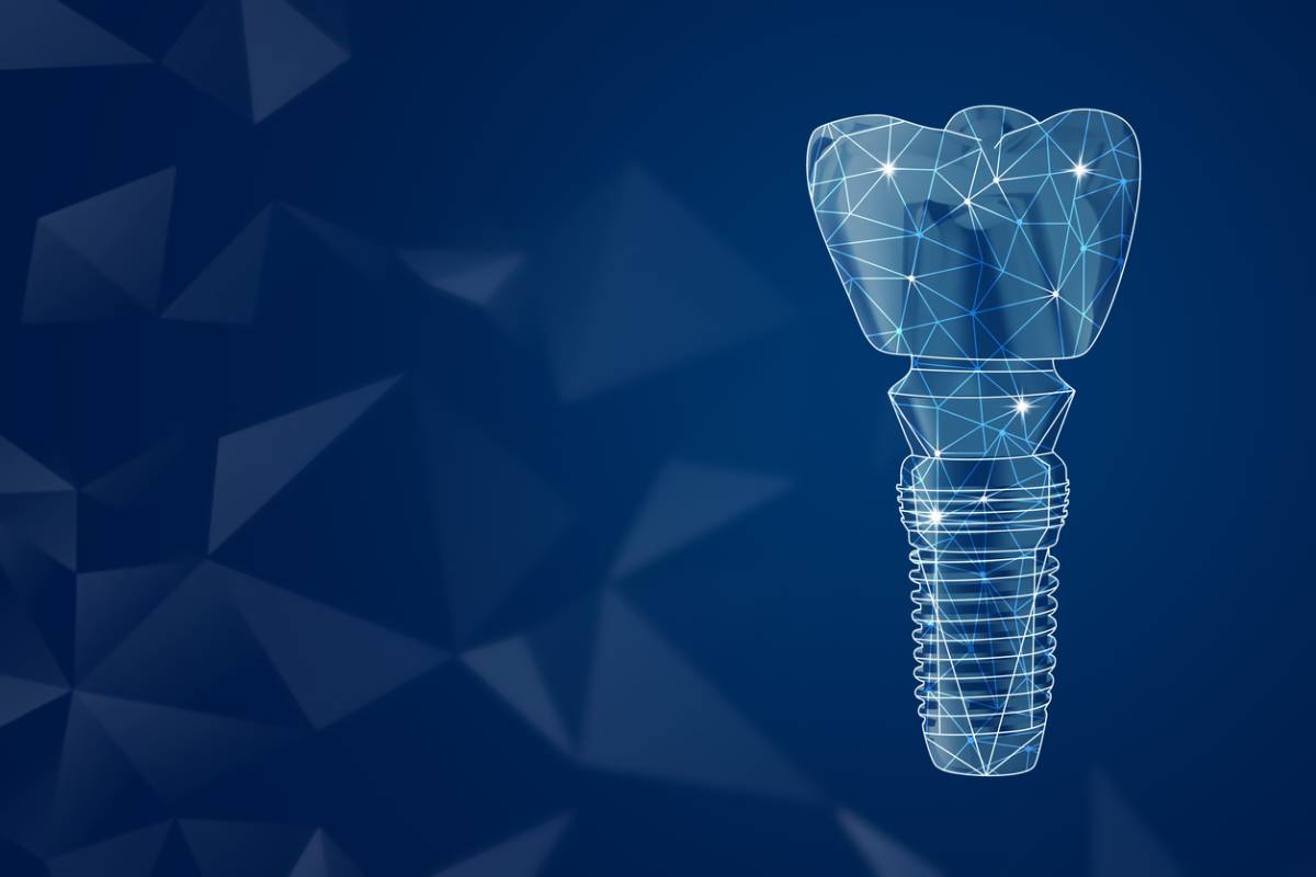 featured image for best materials for dental implants