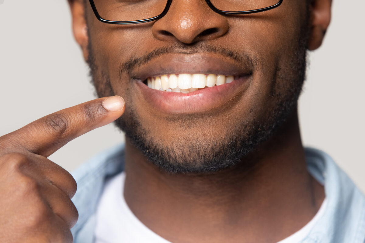 The image shows a closeup view of an African man pointing to his smile to represent how dental implants can boost your confidence.